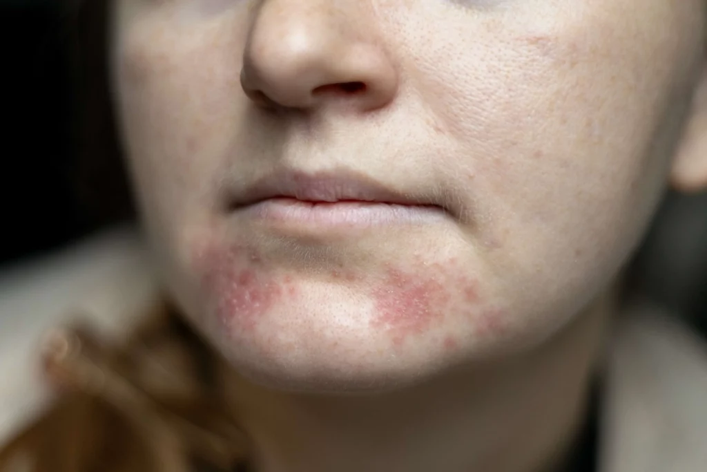 Skincare | Wave Medical Aesthetics | Needham, MA